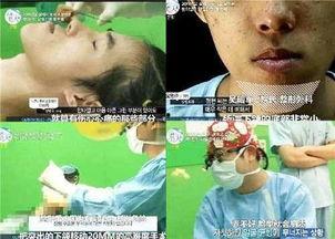 吃瓜下颚破皮视频大全,惊险瞬间！吃瓜下颚破皮视频大盘点